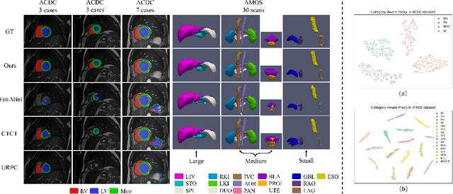 Figure 4 for Inherent Consistent Learning for Accurate Semi-supervised Medical Image Segmentation