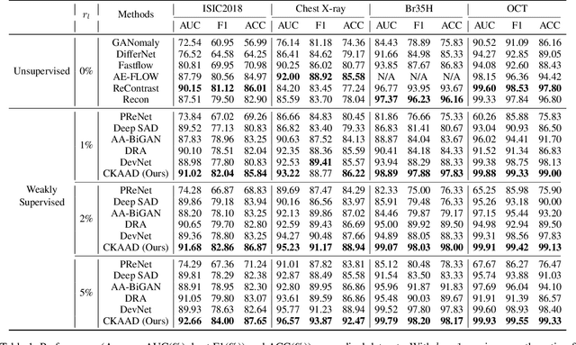 Figure 2 for Boosting Fine-Grained Visual Anomaly Detection with Coarse-Knowledge-Aware Adversarial Learning