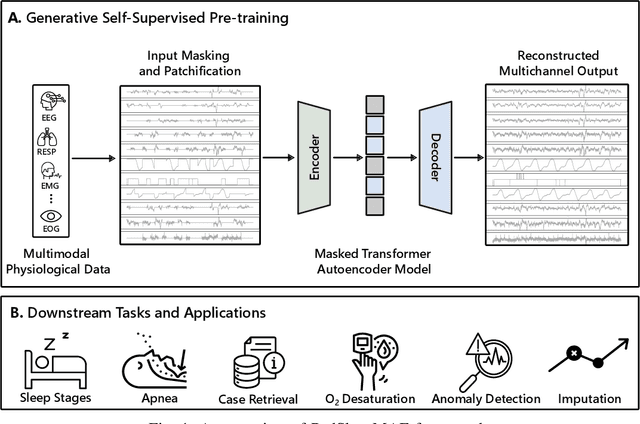 Figure 1 for PedSleepMAE: Generative Model for Multimodal Pediatric Sleep Signals