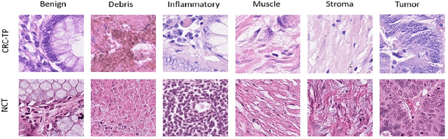 Figure 2 for Domain-Adaptive Learning: Unsupervised Adaptation for Histology Images with Improved Loss Function Combination