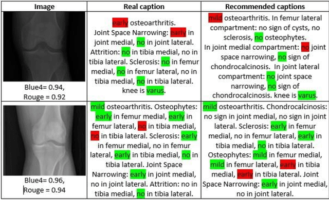 Figure 4 for Application Of Vision-Language Models For Assessing Osteoarthritis Disease Severity