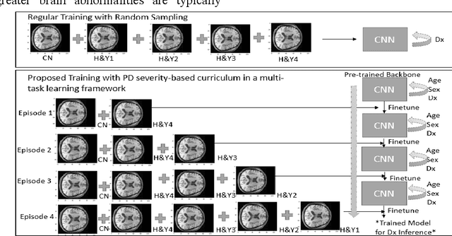 Figure 2 for Curriculum Based Multi-Task Learning for Parkinson's Disease Detection