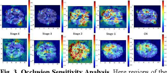 Figure 4 for Curriculum Based Multi-Task Learning for Parkinson's Disease Detection