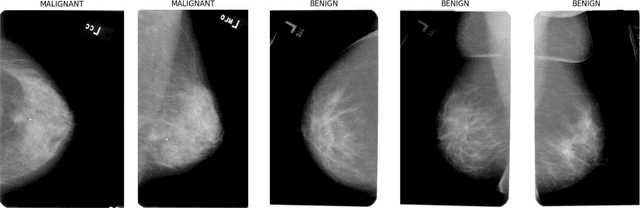 Figure 2 for Transformer-Based Explainable Deep Learning for Breast Cancer Detection in Mammography: The MammoFormer Framework