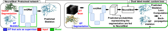 Figure 1 for Enhancing the automatic segmentation and analysis of 3D liver vasculature models