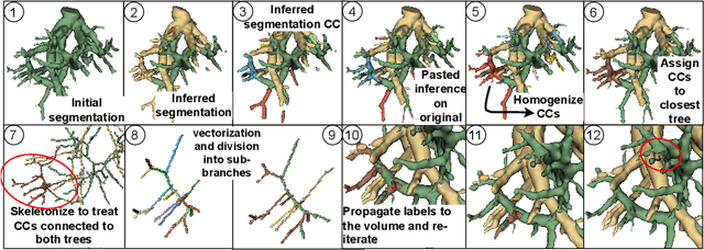 Figure 2 for Enhancing the automatic segmentation and analysis of 3D liver vasculature models