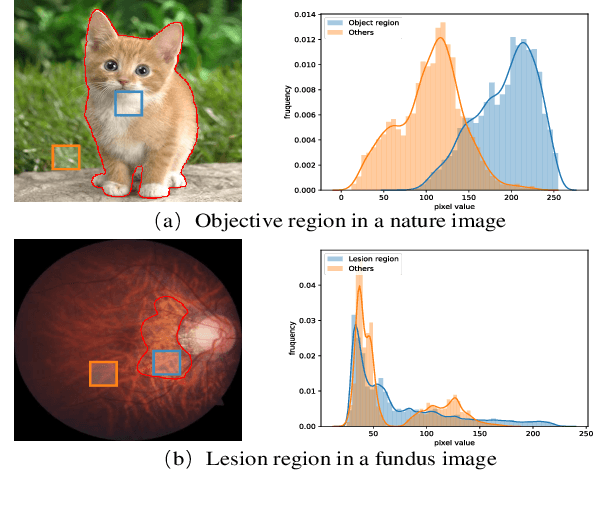 Figure 1 for PPCR: Learning Pyramid Pixel Context Recalibration Module for Medical Image Classification