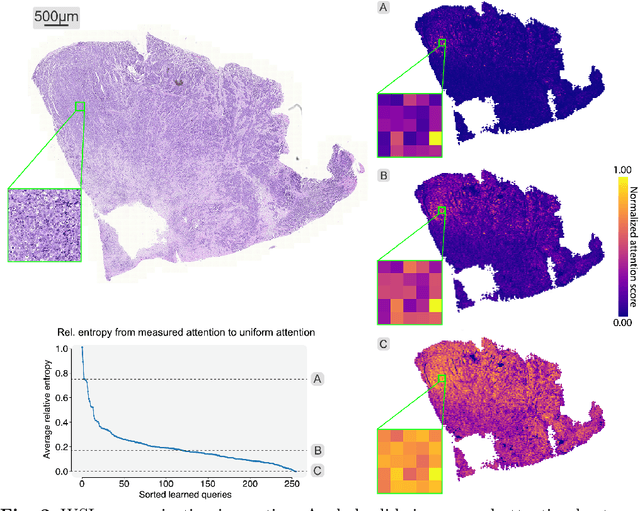 Figure 3 for Language models are good pathologists: using attention-based sequence reduction and text-pretrained transformers for efficient WSI classification