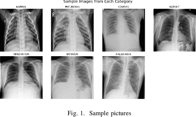 Figure 1 for Lung Disease Detection with Vision Transformers: A Comparative Study of Machine Learning Methods