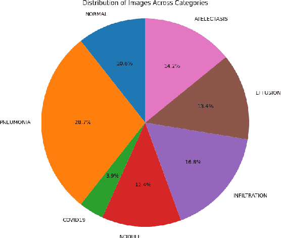 Figure 2 for Lung Disease Detection with Vision Transformers: A Comparative Study of Machine Learning Methods