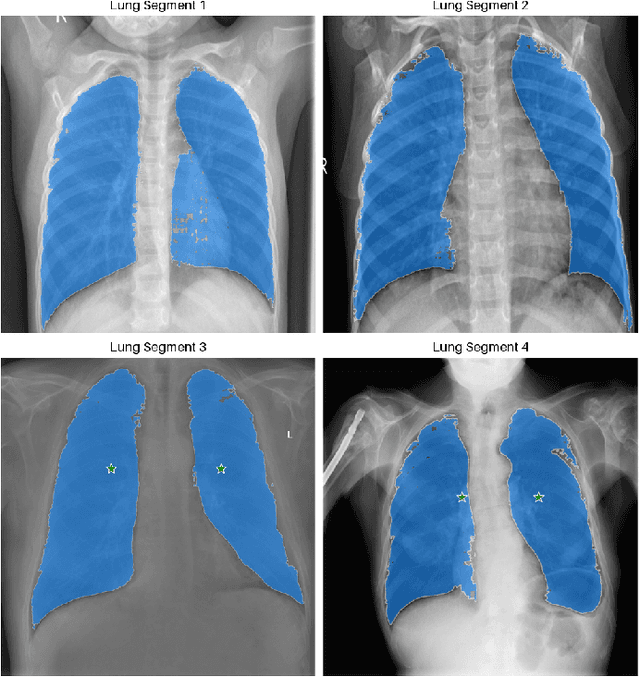 Figure 3 for Lung Disease Detection with Vision Transformers: A Comparative Study of Machine Learning Methods