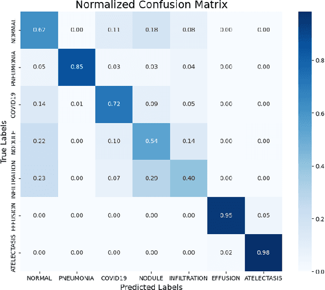 Figure 4 for Lung Disease Detection with Vision Transformers: A Comparative Study of Machine Learning Methods