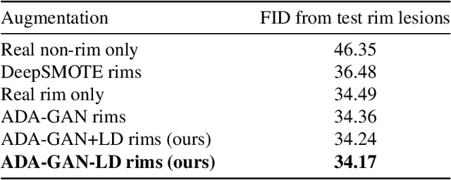 Figure 4 for Synthetic Generation and Latent Projection Denoising of Rim Lesions in Multiple Sclerosis