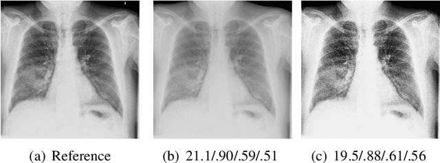 Figure 3 for Parameter choices in HaarPSI for IQA with medical images