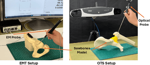 Figure 4 for Partial-to-Full Registration based on Gradient-SDF for Computer-Assisted Orthopedic Surgery