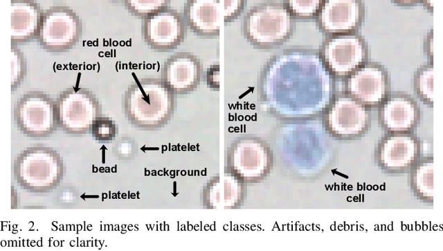 Figure 2 for Masked strategies for images with small objects