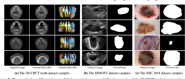 Figure 4 for PMFSNet: Polarized Multi-scale Feature Self-attention Network For Lightweight Medical Image Segmentation