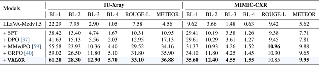 Figure 1 for Visual Alignment of Medical Vision-Language Models for Grounded Radiology Report Generation