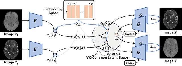 Figure 1 for Non-Adversarial Learning: Vector-Quantized Common Latent Space for Multi-Sequence MRI