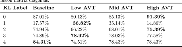 Figure 4 for Adaptive Variance Thresholding: A Novel Approach to Improve Existing Deep Transfer Vision Models and Advance Automatic Knee-Joint Osteoarthritis Classification