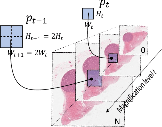 Figure 2 for Renal Cell Carcinoma subtyping: learning from multi-resolution localization