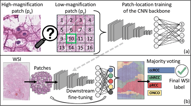 Figure 4 for Renal Cell Carcinoma subtyping: learning from multi-resolution localization
