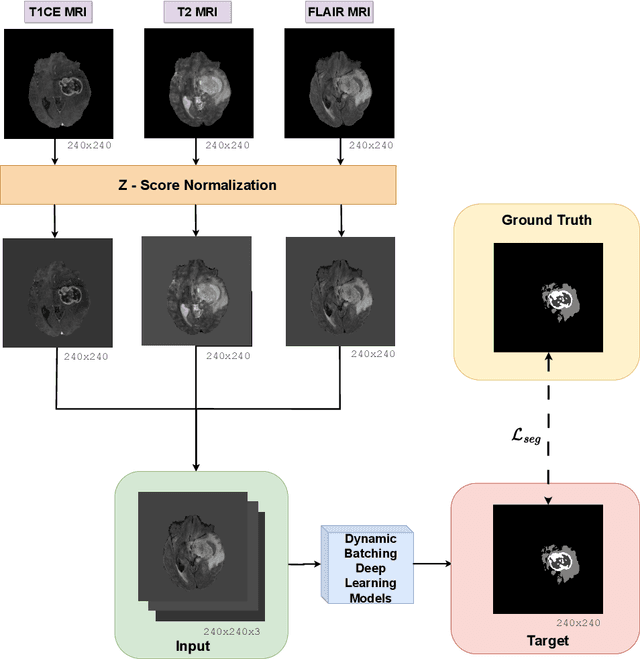 Figure 1 for Detection of Under-represented Samples Using Dynamic Batch Training for Brain Tumor Segmentation from MR Images