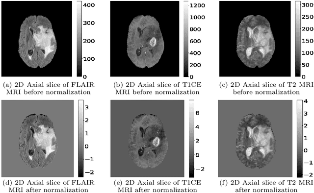 Figure 3 for Detection of Under-represented Samples Using Dynamic Batch Training for Brain Tumor Segmentation from MR Images