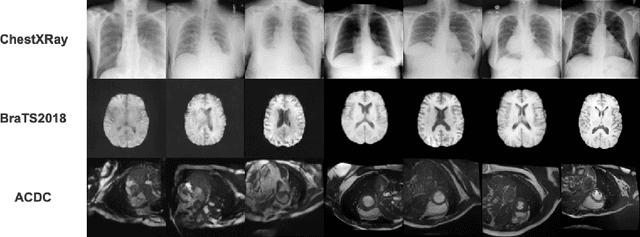 Figure 2 for VM-DDPM: Vision Mamba Diffusion for Medical Image Synthesis