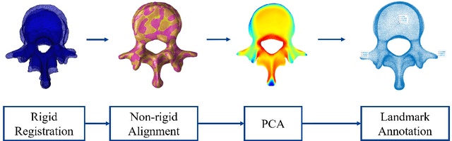 Figure 2 for Three-dimensional Reconstruction of the Lumbar Spine with Submillimeter Accuracy Using Biplanar X-ray Images