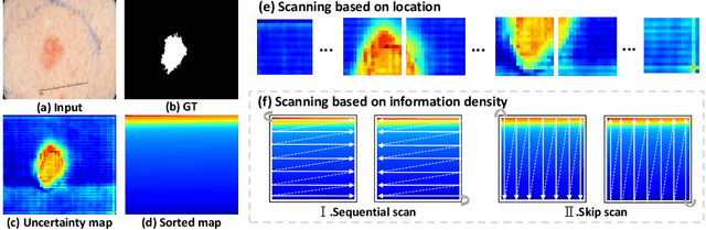 Figure 1 for UD-Mamba: A pixel-level uncertainty-driven Mamba model for medical image segmentation