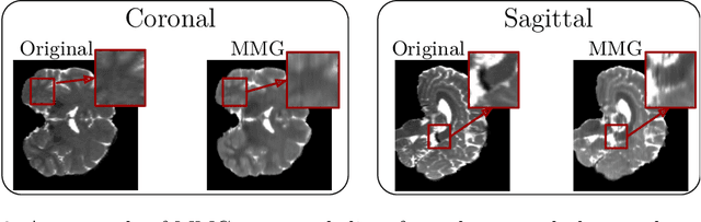 Figure 3 for SLaM-DiMM: Shared Latent Modeling for Diffusion Based Missing Modality Synthesis in MRI