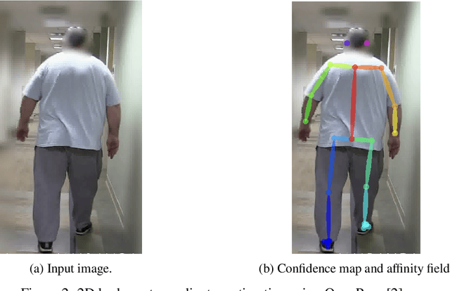 Figure 3 for AtGCN: A Graph Convolutional Network For Ataxic Gait Detection