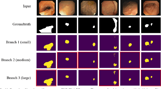 Figure 3 for Size Aware Cross-shape Scribble Supervision for Medical Image Segmentation