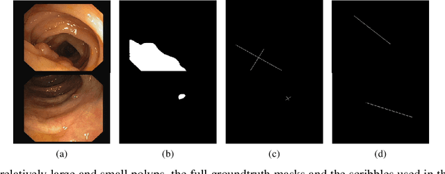 Figure 1 for Size Aware Cross-shape Scribble Supervision for Medical Image Segmentation