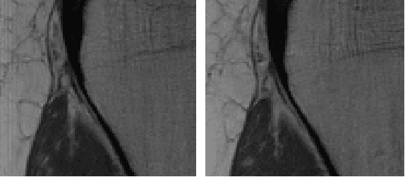 Figure 1 for Investigating the Feasibility of Patch-based Inference for Generalized Diffusion Priors in Inverse Problems for Medical Images