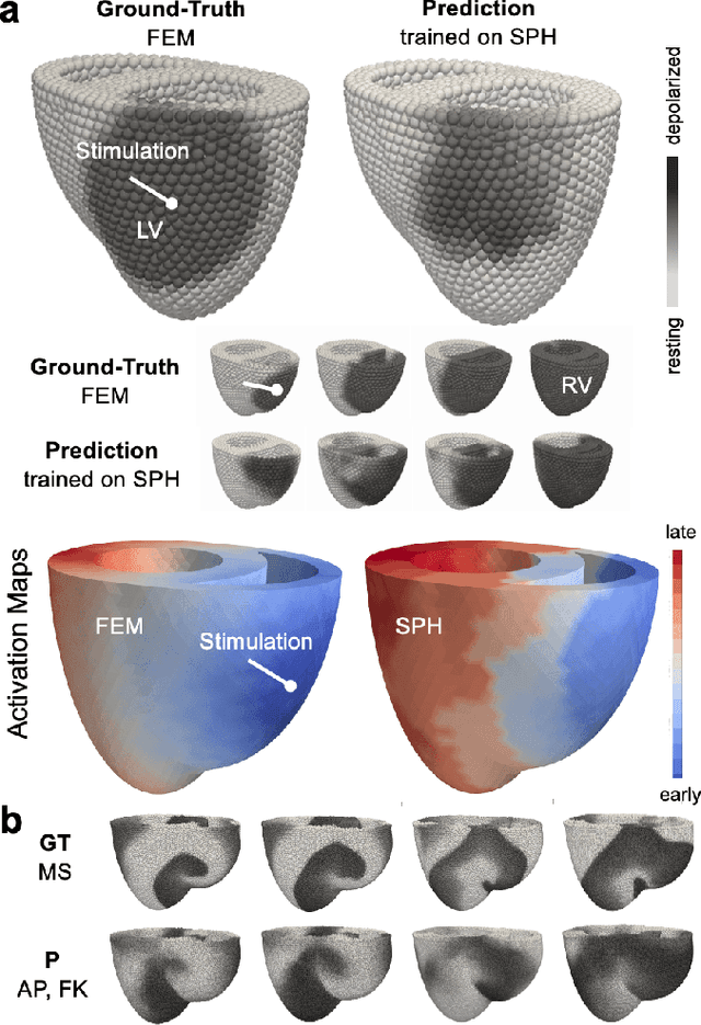 Figure 4 for Deep Learning-based Prediction of Electrical Arrhythmia Circuits from Cardiac Motion: An In-Silico Study