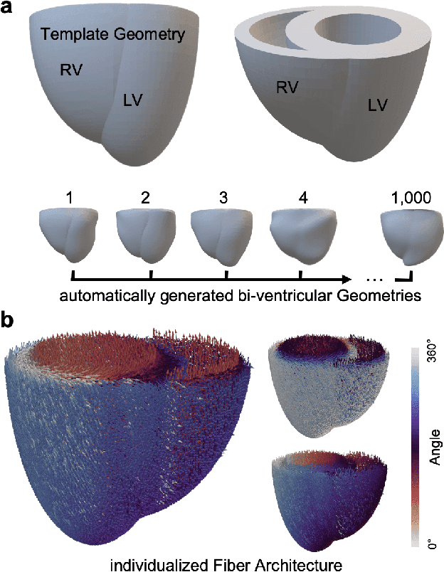 Figure 1 for Deep Learning-based Prediction of Electrical Arrhythmia Circuits from Cardiac Motion: An In-Silico Study