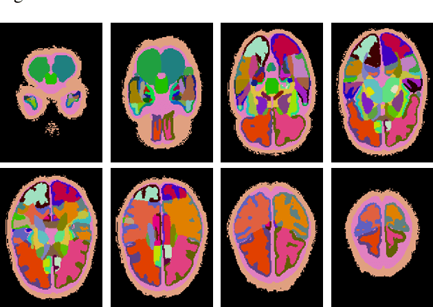 Figure 2 for A Novel Collaborative Self-Supervised Learning Method for Radiomic Data