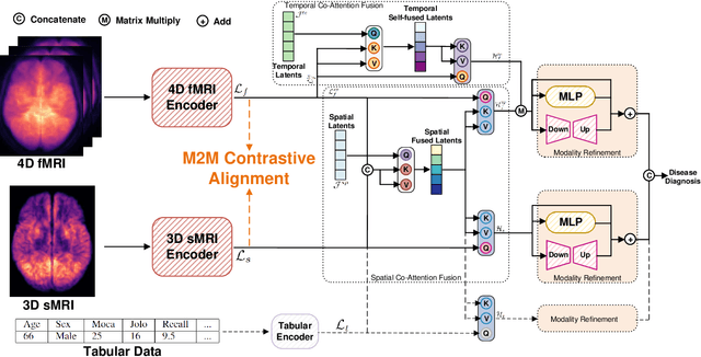 Figure 1 for 4D Multimodal Co-attention Fusion Network with Latent Contrastive Alignment for Alzheimer's Diagnosis