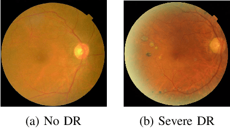 Figure 2 for From Retinal Pixels to Patients: Evolution of Deep Learning Research in Diabetic Retinopathy Screening