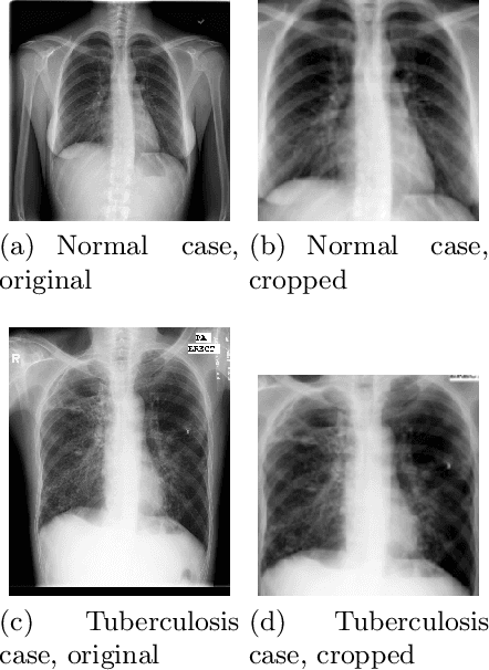 Figure 3 for An Explainable Hybrid AI Framework for Enhanced Tuberculosis and Symptom Detection