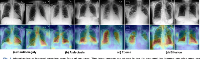 Figure 4 for Enhancing medical vision-language contrastive learning via inter-matching relation modelling