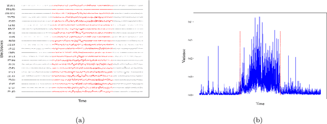 Figure 3 for Early Warning via tipping-preserving latent stochastic dynamical system and meta label correcting