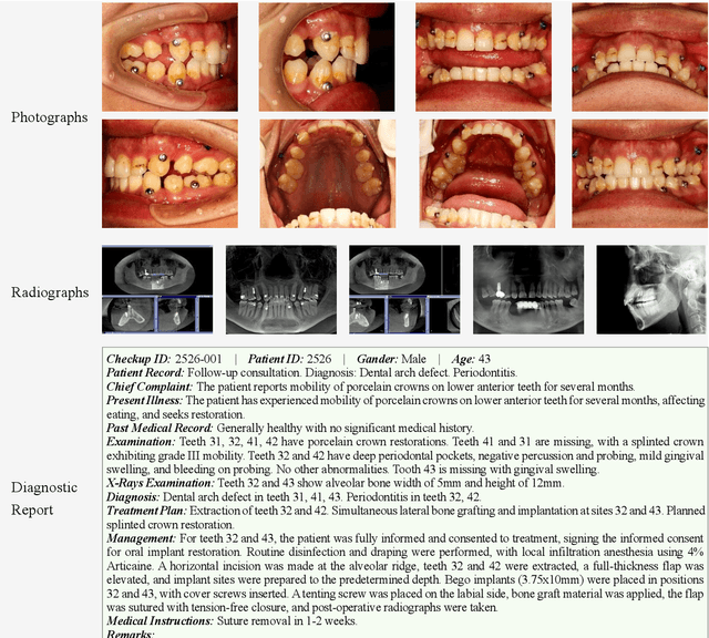 Figure 3 for A benchmark multimodal oro-dental dataset for large vision-language models