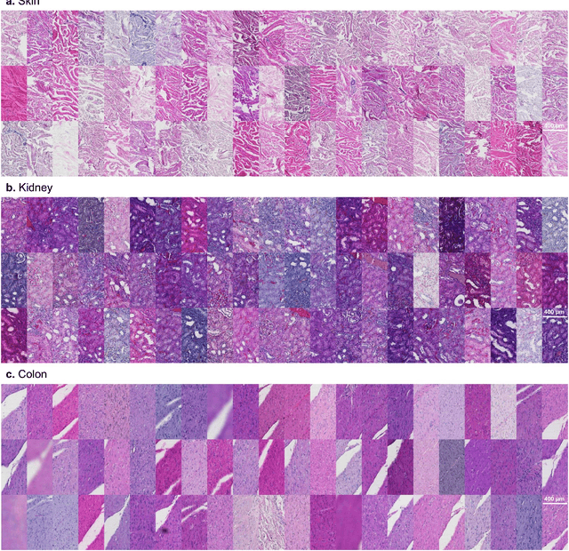 Figure 1 for Staining normalization in histopathology: Method benchmarking using multicenter dataset