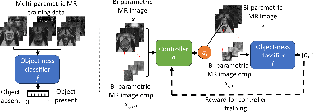 Figure 1 for Weakly supervised localisation of prostate cancer using reinforcement learning for bi-parametric MR images