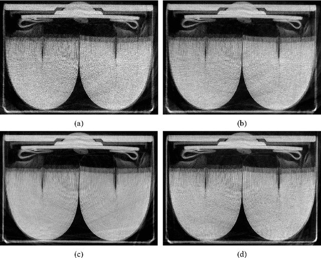 Figure 4 for A CT Image Denoising Method Based on Projection Domain Feature