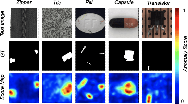 Figure 1 for That's BAD: Blind Anomaly Detection by Implicit Local Feature Clustering