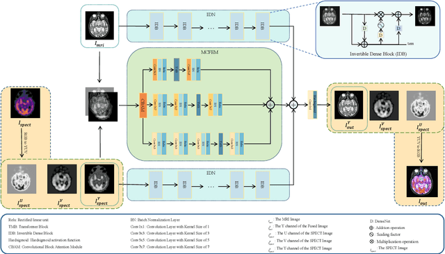 Figure 3 for MMIF-AMIN: Adaptive Loss-Driven Multi-Scale Invertible Dense Network for Multimodal Medical Image Fusion